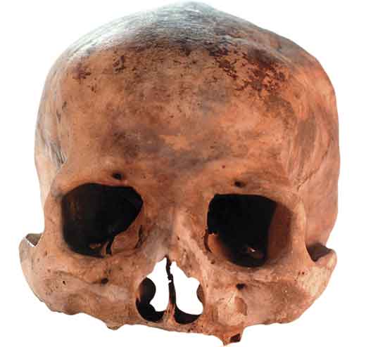 Fotografia de um crânio de frente, porém sem as mandíbulas e os dentes.