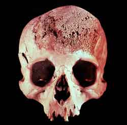 A imagem apresenta um crânio de frente, sem mandíbulas.