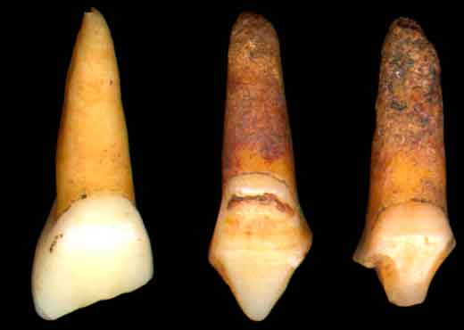 Nesta fotografia veem-se quatro dentes humanos ancestrais cortados e com pontas esculpidas.