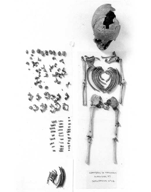 A foto está em preto e branco e mostra um esqueleto com o crânio quebrado, sem mãos e pés, além de dezenas de pequenos ossos organizados ao lado.