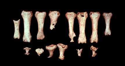 A foto revela ossos das mãos ou pés, denominados falanges, além de vértebras, que compõem a coluna.