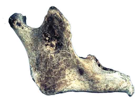 Fotografia de um osso do corpo humano.