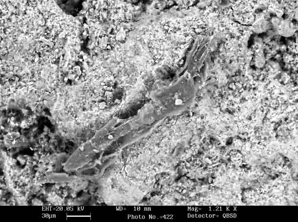 A foto está em preto e branco e mostra imagem microscópica ampliada de um fragmento de osso.