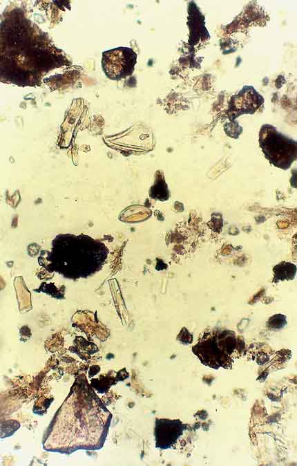 A fotografia mostra imagem microscópica de partículas coloridas.